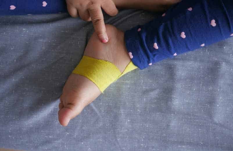 Remède miracle pour entorse de cheville chez l’enfant : 3 astuces naturelles-Lulu Nature