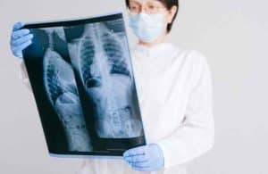 Peut-on vivre longtemps avec de l’emphysème ? Lulu Nature