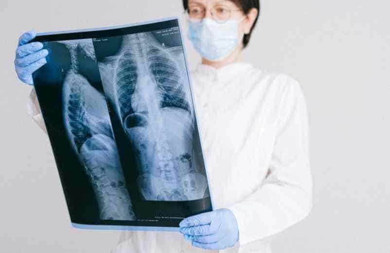 Peut-on vivre longtemps avec de l’emphysème ? Lulu Nature