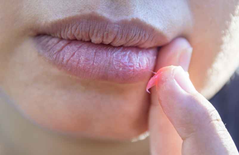 Prévenir les récidives et protéger la peau-Lulu Nature