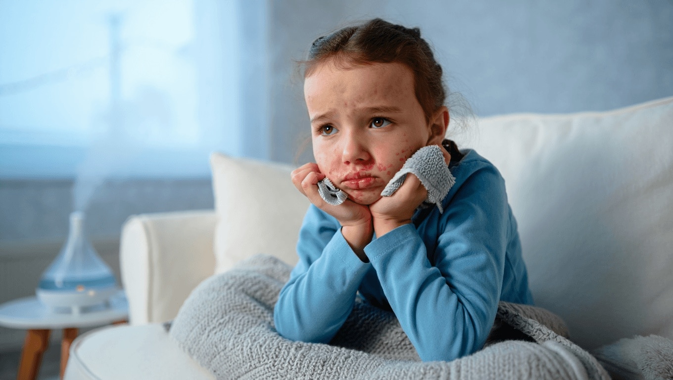Hiver : comment protéger la peau des enfants contre la sécheresse, l'eczéma et les lèvres gercées ?