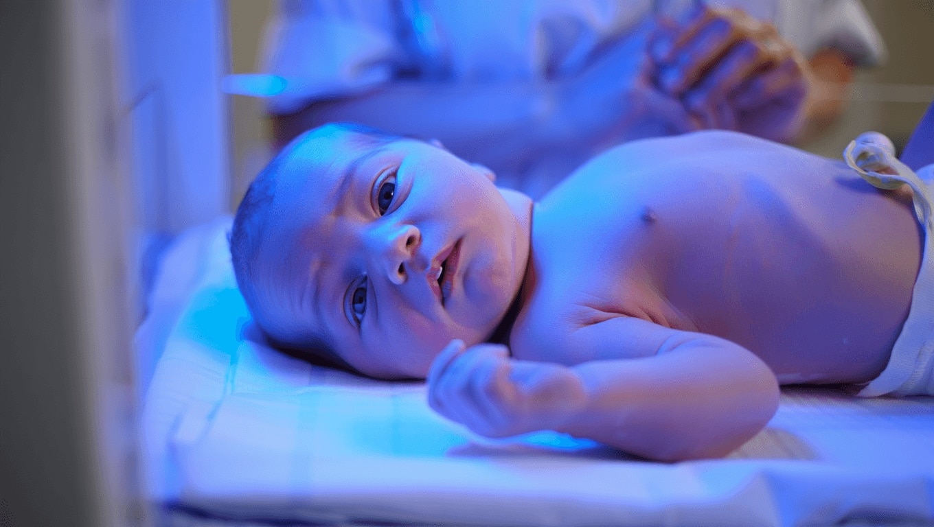 Quand un bébé doit-il faire de la photothérapie ?