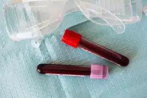 Professionnel de santé prélevant un échantillon de sang sur un nouveau-né pour déterminer le groupe sanguin