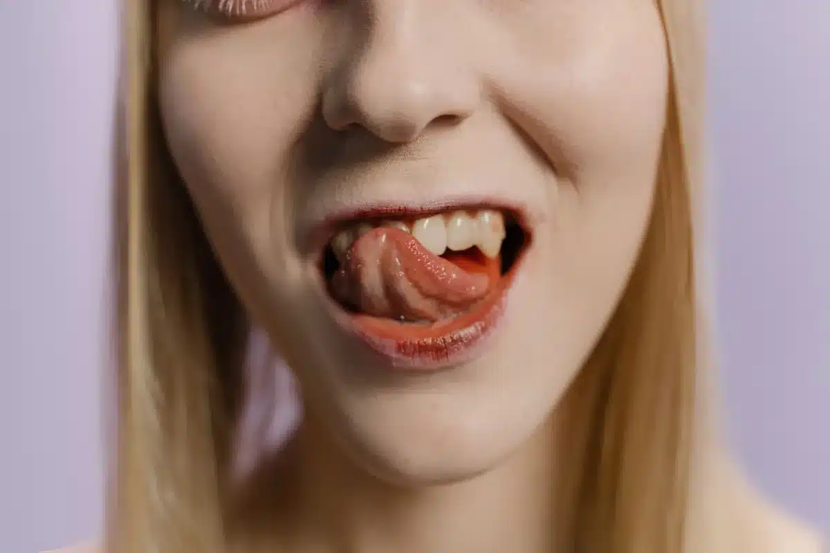 Gros plan sur une bouche sèche, illustrant le symptôme classique de déshydratation.